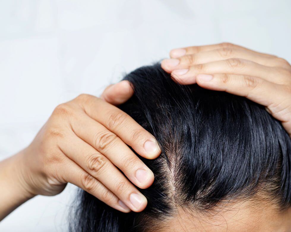 vitamine per prevenzione naturale caduta dei capelli